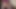Foreskin movement (slowmotion) 779