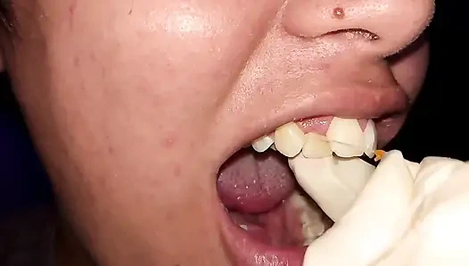Trying to Use Dental Floss (close-up)