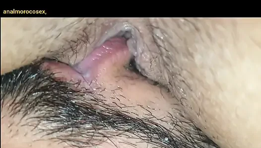 I went to my stepaunt's house. Her son woke up at night and the shopkeep...