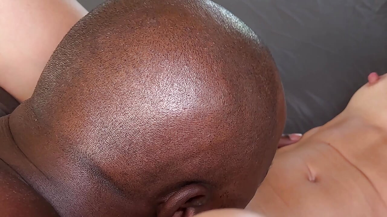 Kala varchasv - gori larkiyon ke lie koee daya nahin