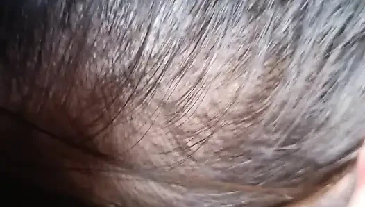 FAHIŞE YARAĞıMı EMMEYE DEVAM EDIYOR