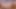Penis pump on my cervix
