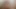 LizzyYum January 20 2024 DYE 01 Post Op Orgasm Pussy anal Masturbation Teasing