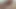 Lizzy Yum November 2023 SEXDOLL #8 Post Op Orgasm Pussy Masturbation Teasing