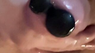 10mm + 5mm dilatátor, poslední bit