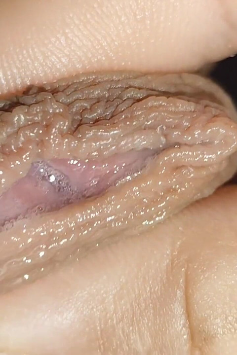 Glans Eye Watering After Intense Fucking