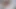 LizzyYum February 2024 daily #1 Post Op Orgasm anal masturbation Pussy teasing