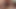 マティンの蹴上げ