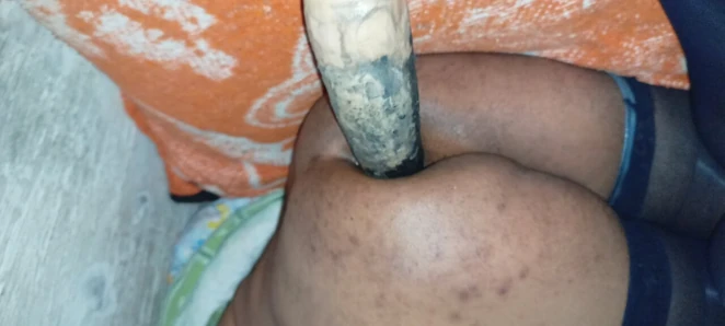 Hvcf