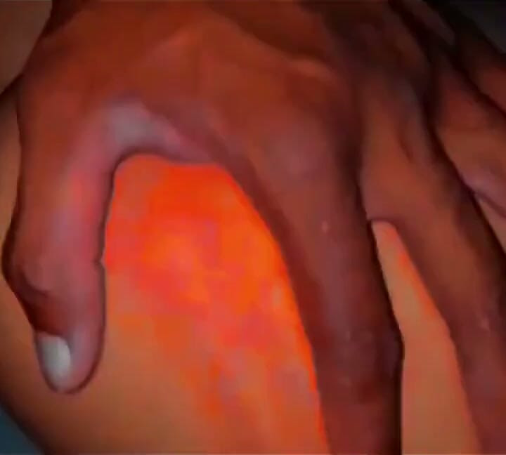 Bana vurdu ve sonra götüme soktu, bana köle gibi davranıyor ve tokatları ve spermiyle götümde iz bıraktı