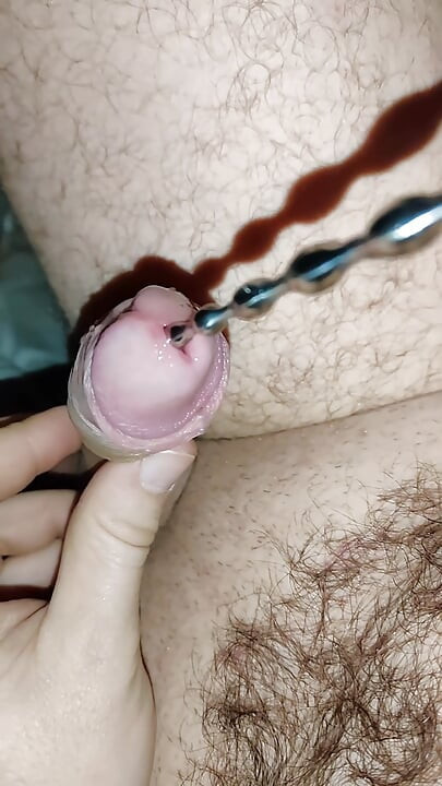 A Large Dilator in My Stepbrother's Cock