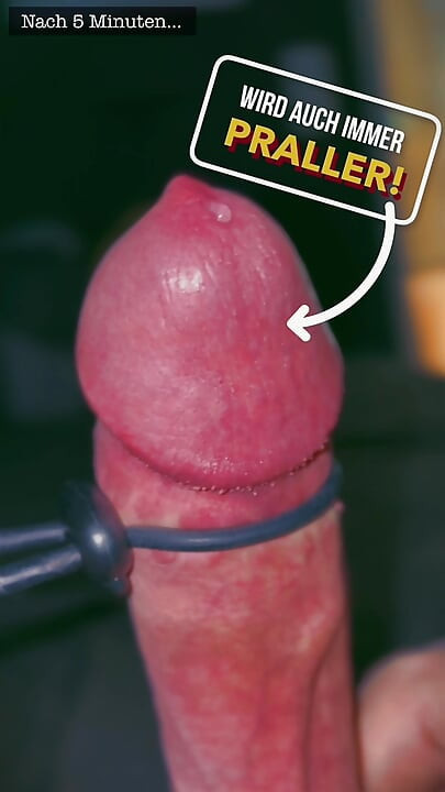 E-stim (edição dork)