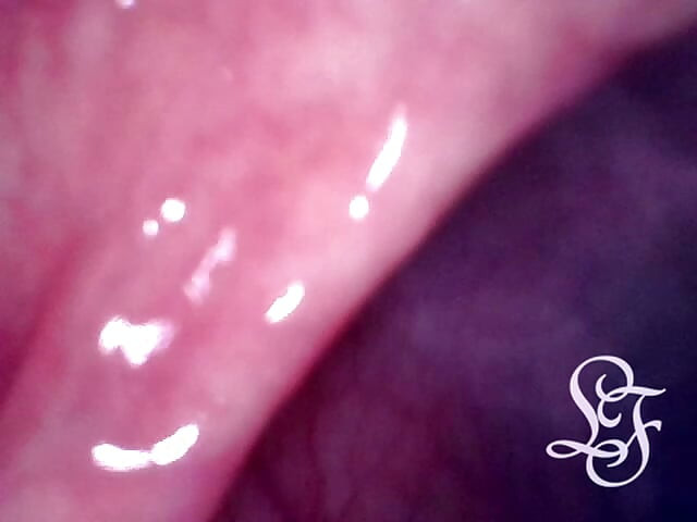我灌肠的时候，来看看我的屁眼里面！