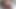 Anal gape scene - Ass Opener - Hot girl ass hole fucking