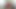 インタビュー・ティッツ