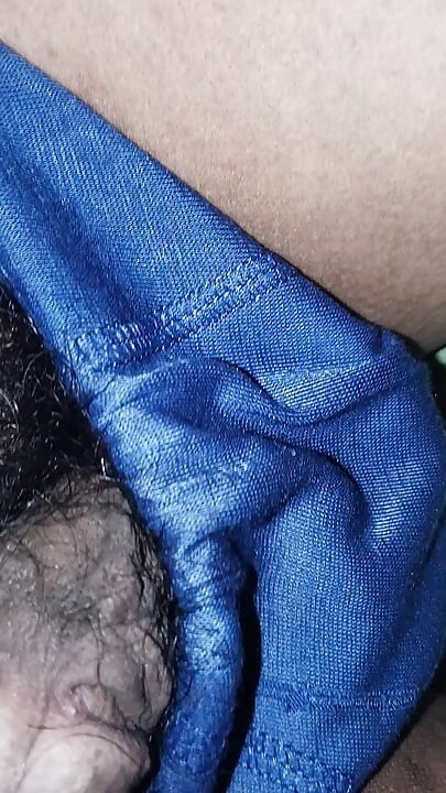 Acne on my penis I want to clean it up