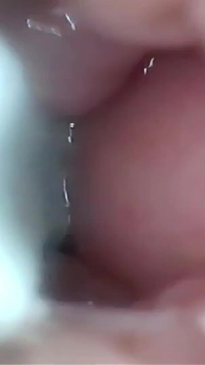 Semen in Cervix Wide Stretching Pussy Endoscope! | Clip 1