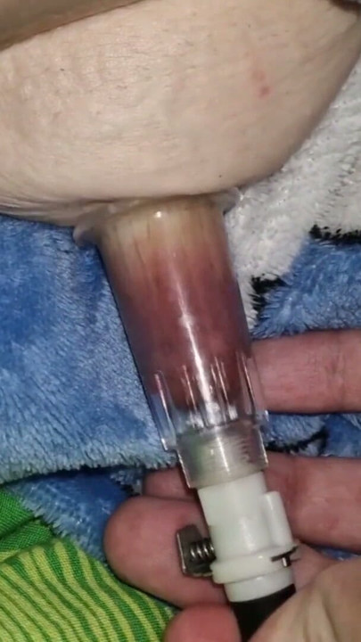 Nipple Suction Pumping . We're playing with my nipple . | Clip 2