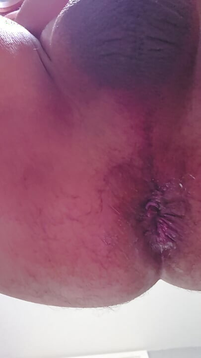 Ladydtf69's cuckold husband stretches his dirty asshole with anal dilator.