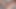 DP アップサイドダウン