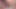 Mikro penis – tekrar aşağı
