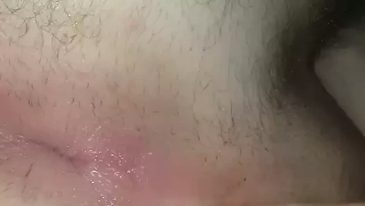 asshole after heavy anal