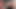 Foreskin mega compilation - 9 videos 35 minutes