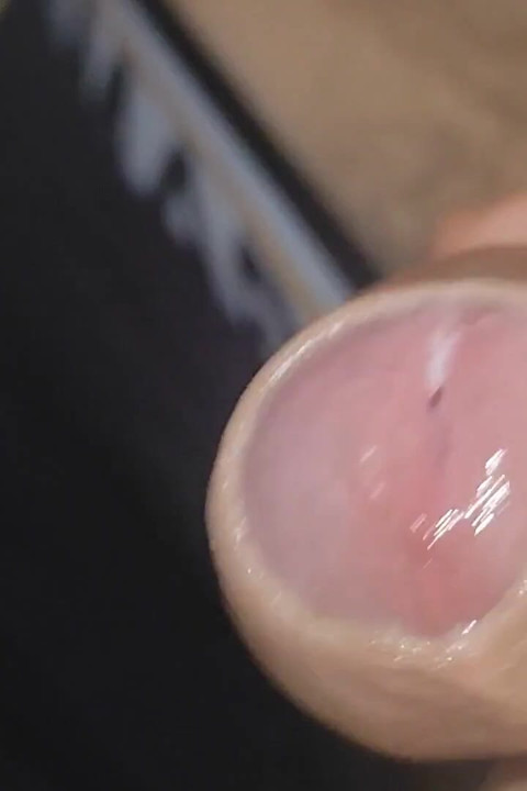 Amazing Upright Rough Venous Frenulum