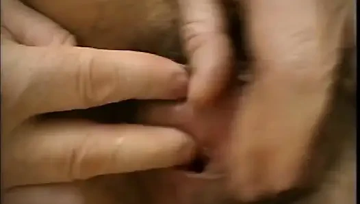 Let's Measure the Fever