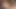 Breast Parts Vol 96: MiXXXed Nuts Edition