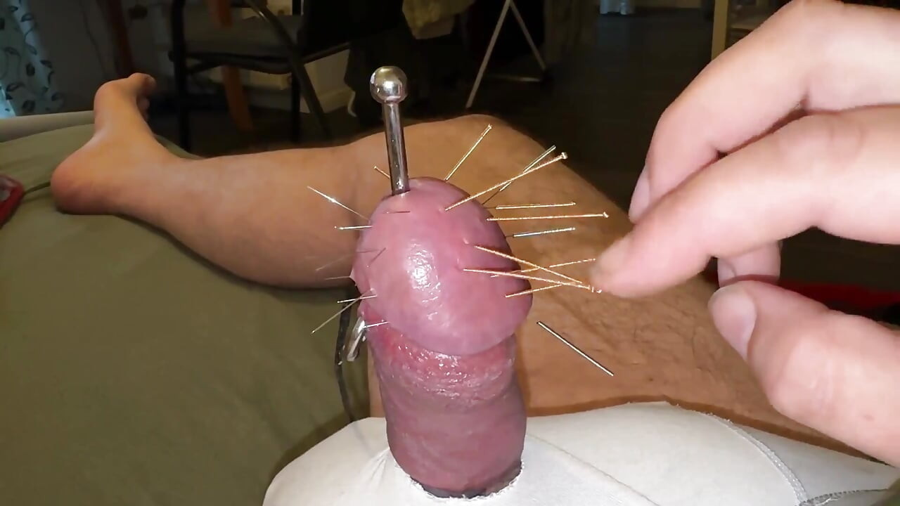 Acupuncture - Orgasm!