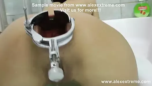 Alexextreme - anal fisting, speculum, prolapse, extreme dildo