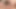 Orgasm contractions