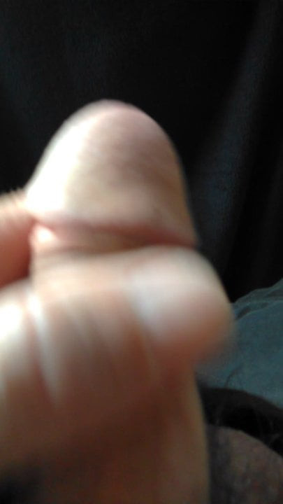 pette bite