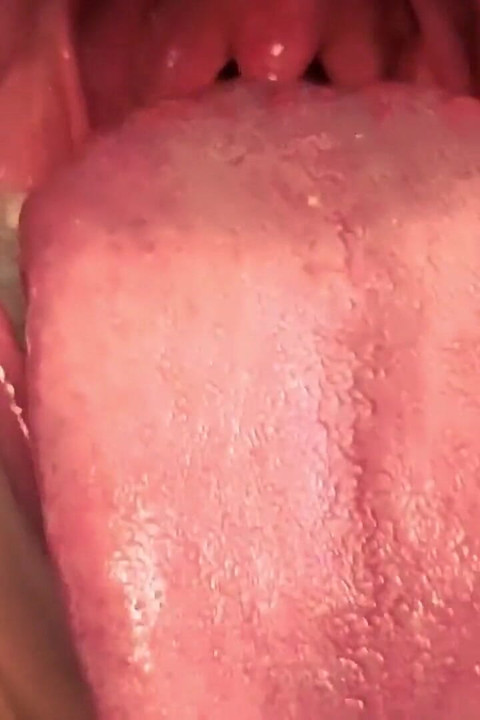 Uvula Fetish