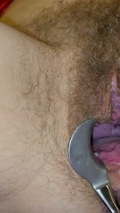 Er het e Spekulum i mini Fotz ine do, wo si komplett ufgmacht het, und mini Cervix zeigt. Also nimm i en Vibrator und fang a… | Clip 1