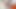 Small Penis Micropenis Little Cock Masturbation