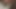Lesbian Tongue Sucking