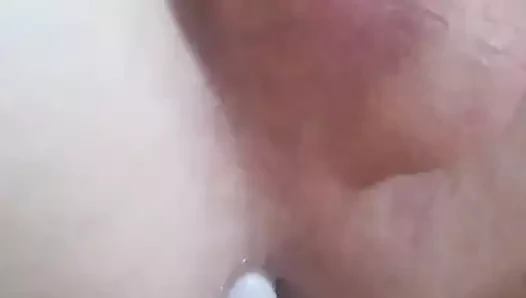 anal