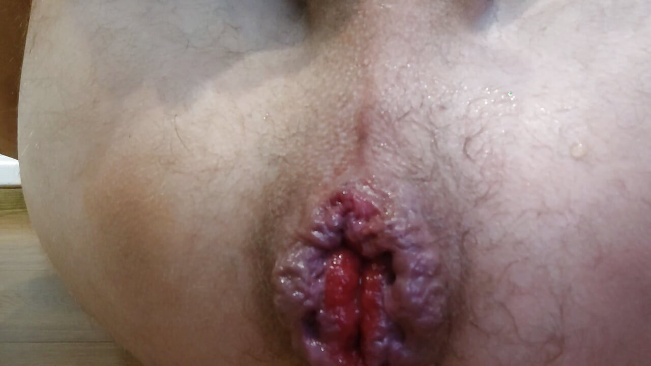 anal