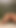 anal