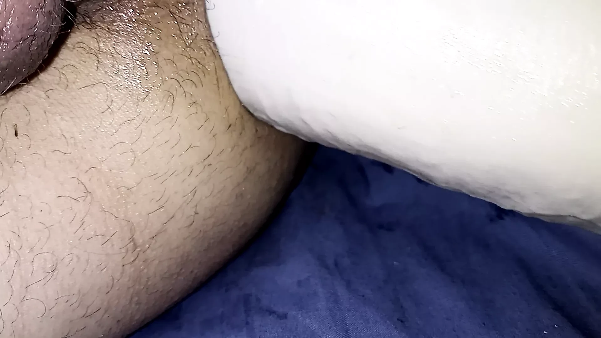 Anal dilatasi