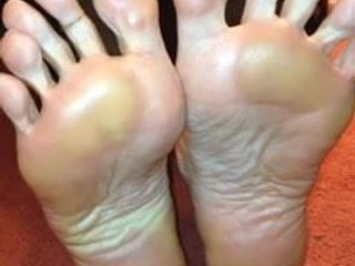 Arricciatura delle dita dei piedi 3