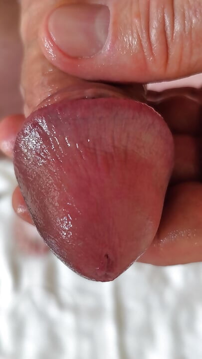 Foreskin back