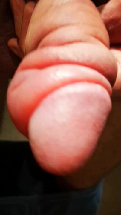 Swallen Cock after 2h Pumping