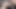 Gyno Chair ButtFucking - Nothing says I Love U like Anal Sex. Rizin' Studio. 4K. view 2