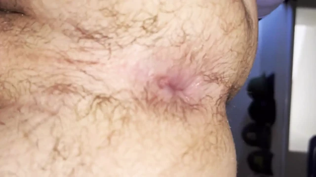 Closeup Assplay