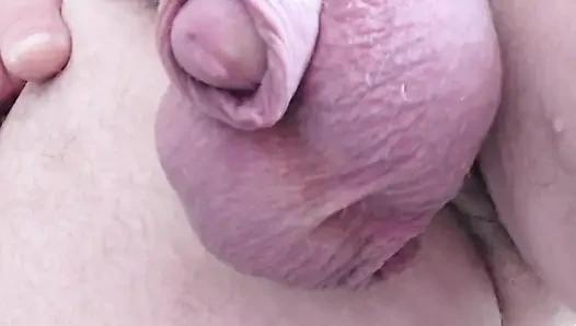 Kalın Skrotum Ve Küçük Penis Ile Işemek