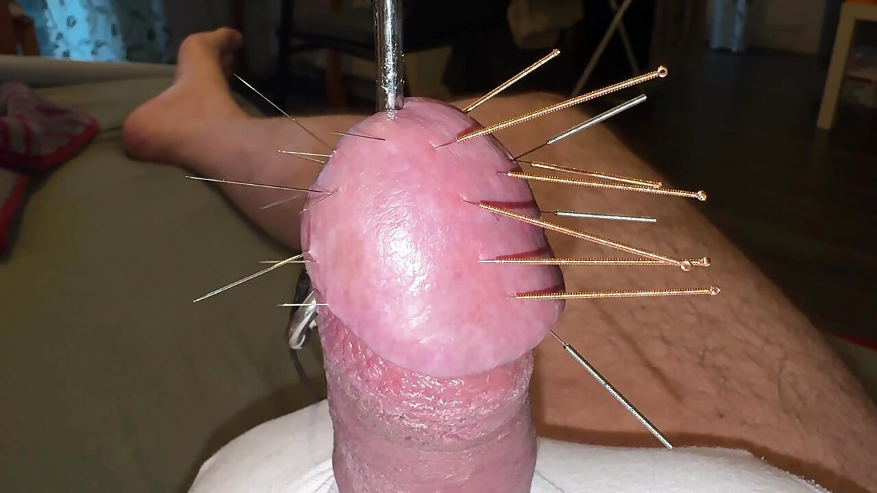 ¡acupuntura - ¡orgasmo!