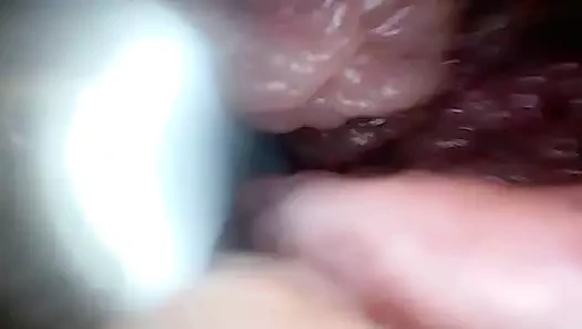 Endoscope Camera Shows the Most Sensitive Parts of the Penis Educational Video